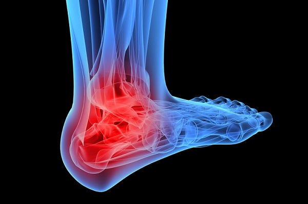best shoes for tarsal tunnel syndrome