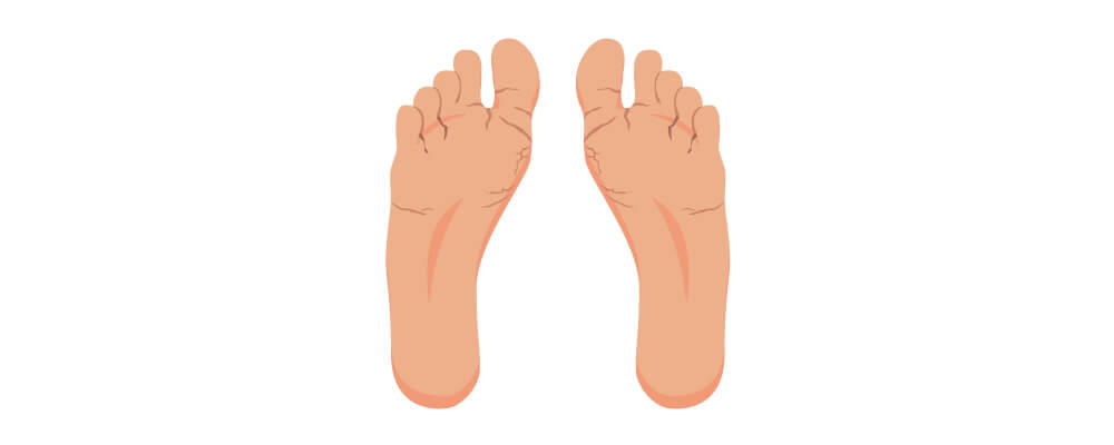 How Is Athlete’s Foot Spread